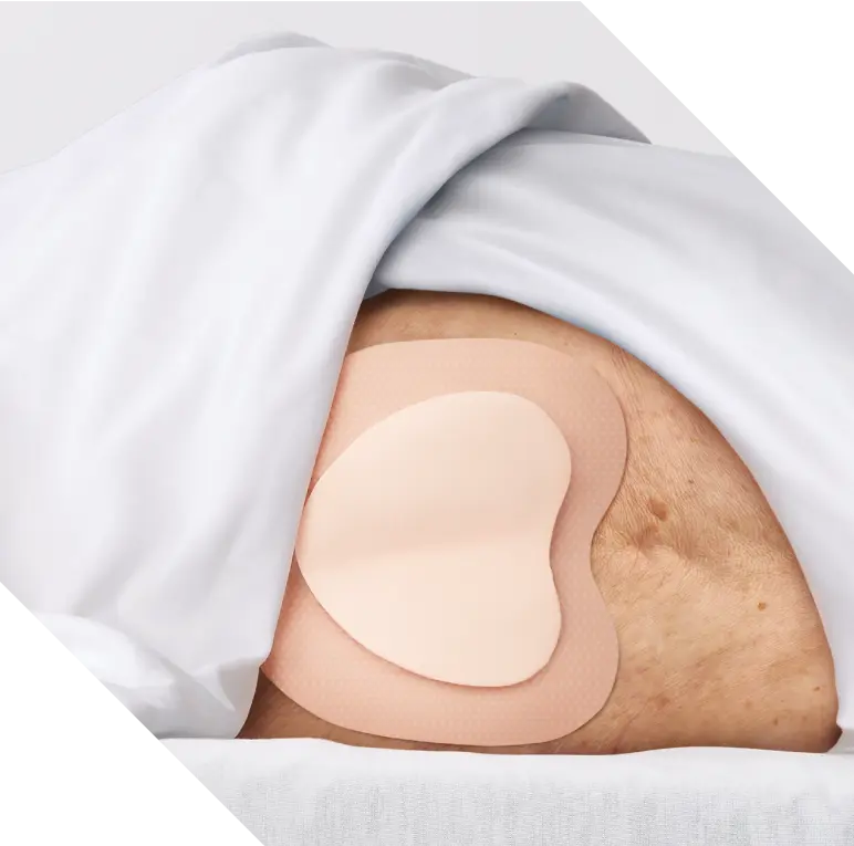 Prevent pressure injuries with a 5-layer bordered foam dressing - Medline Prevent pressure injuries with a 5-layer bordered foam dressing - Medline