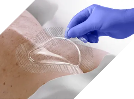 Advanced Wound Care - Medline